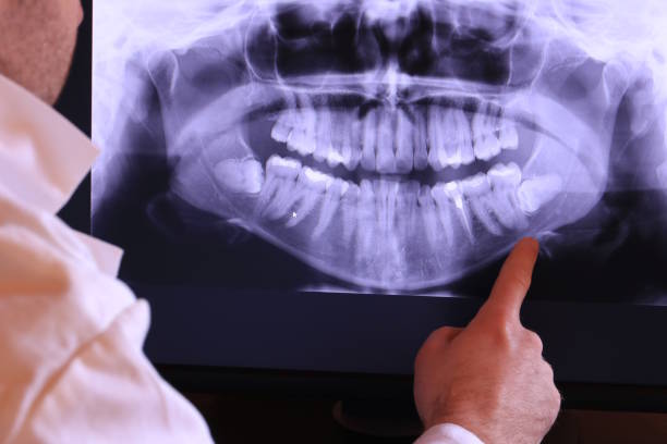 Best Emergency Root Canal Treatment in Cannon Af, NM