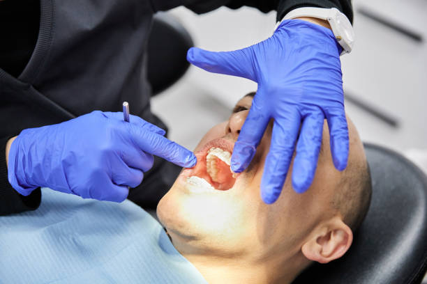 Best Emergency Wisdom Teeth Removal in Cannon Af, NM