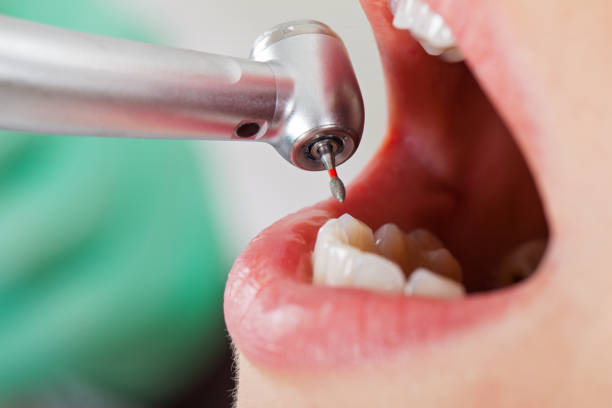Best Emergency Treatment for Toothache in Cannon Af, NM
